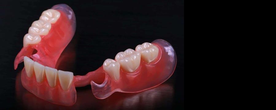 elasticna proteza za zube