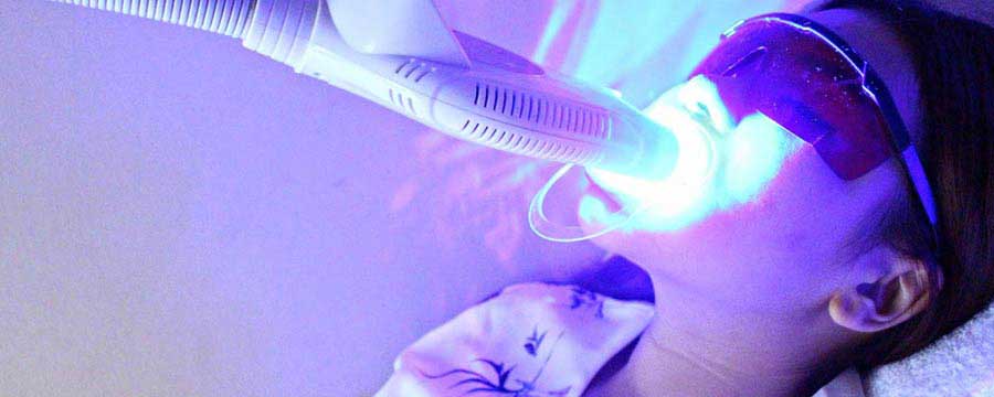 beljenje zuba lampom